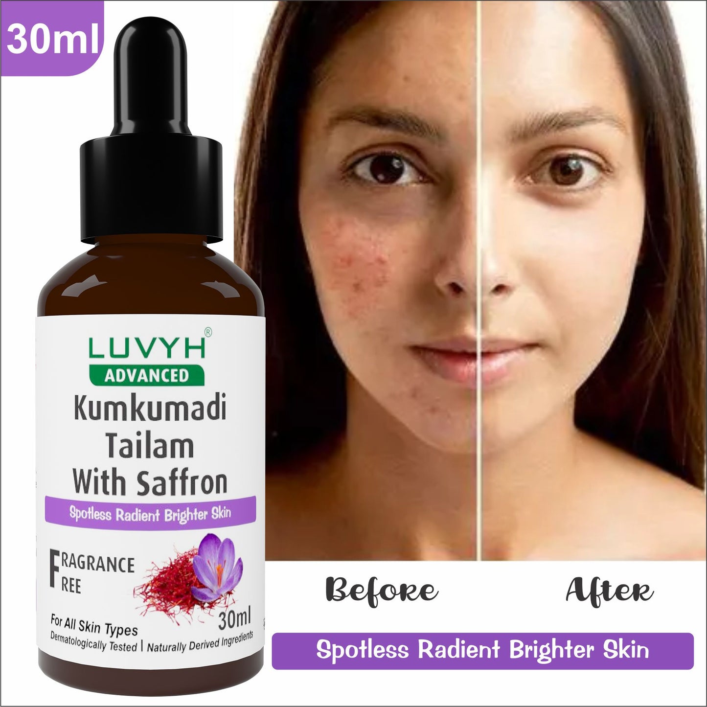 Before and After result - Kumkumadi Tailam with Saffron Serum