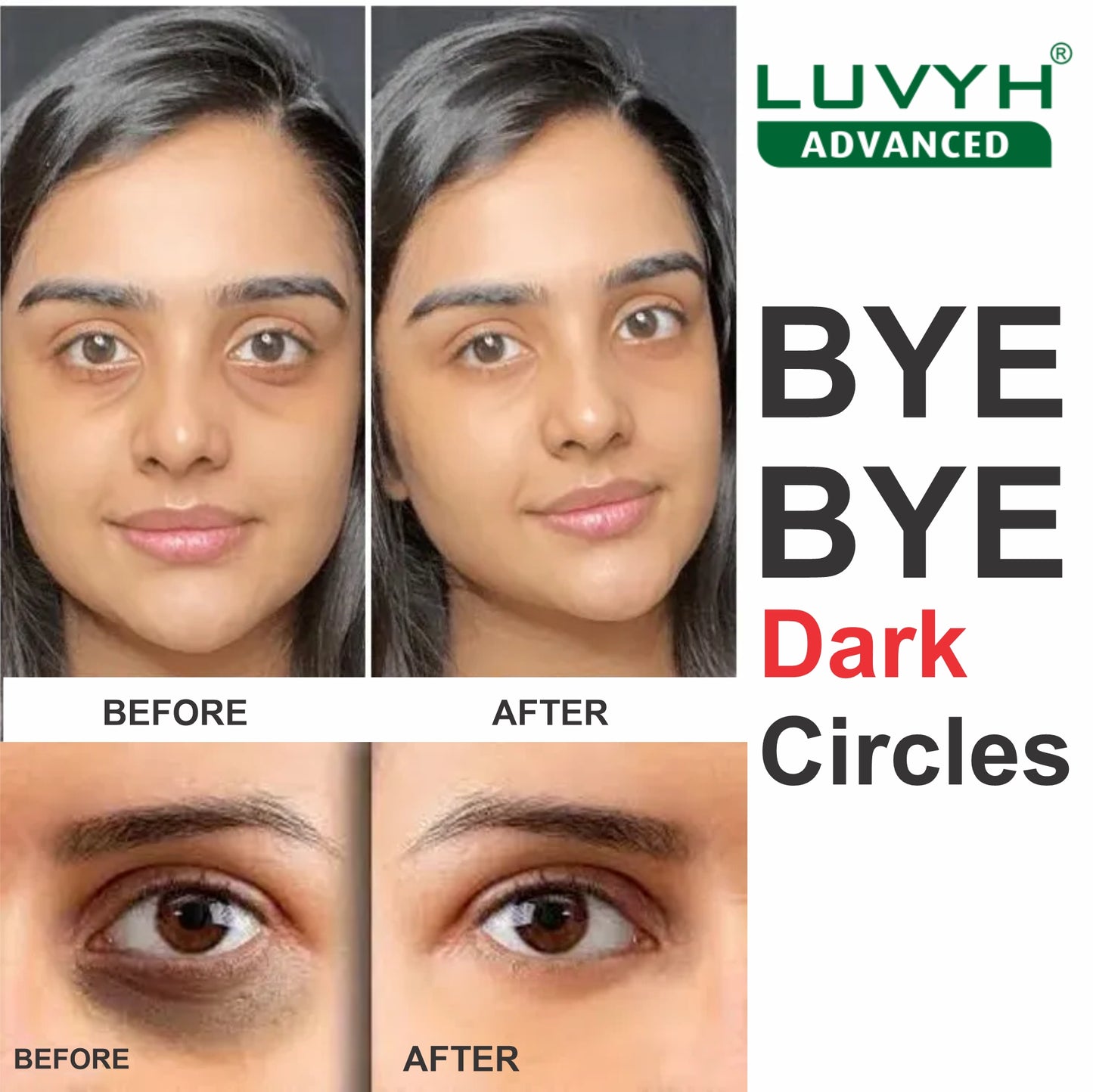 Before & After Results of Under Eye Cream