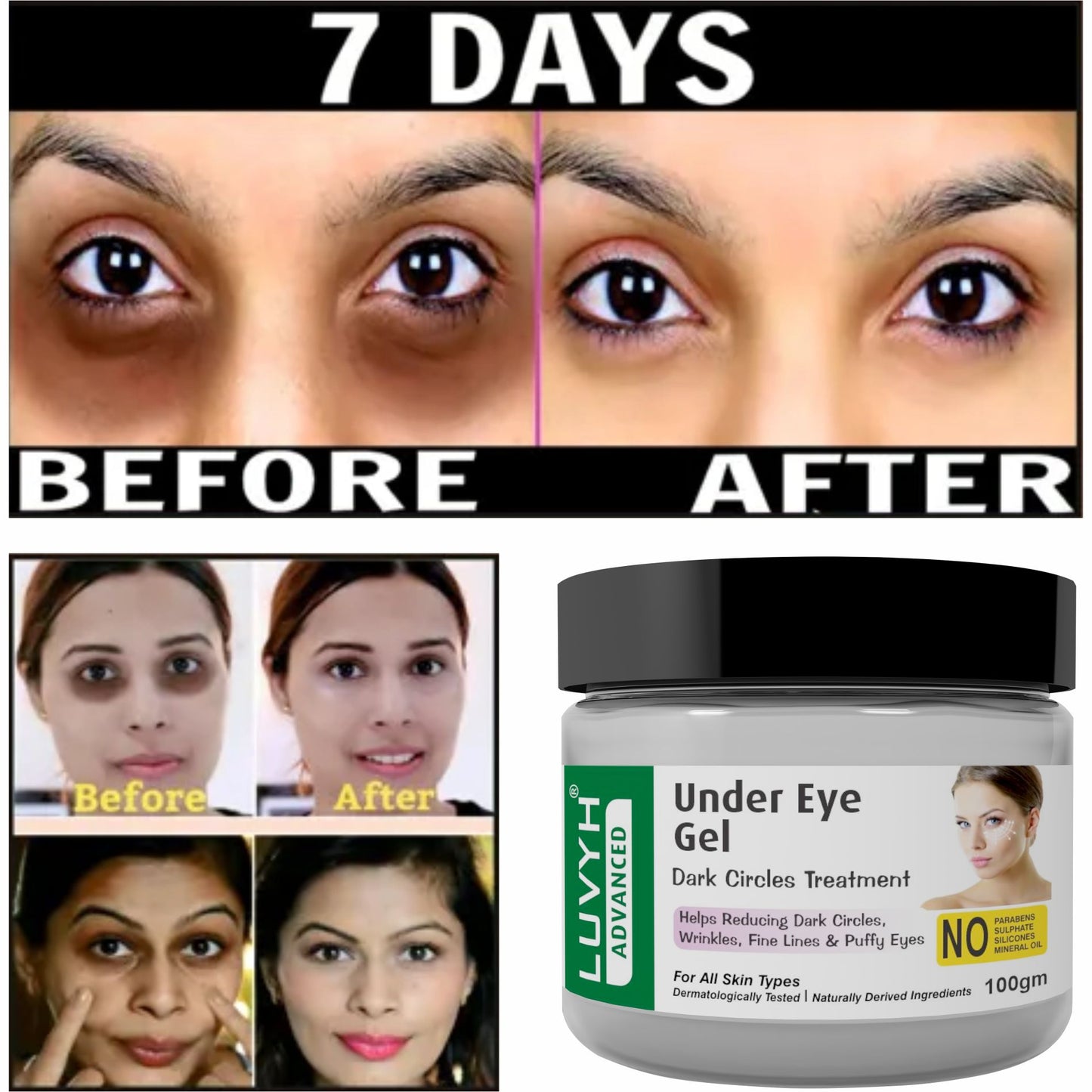 Before & After results of Under Eye Gel