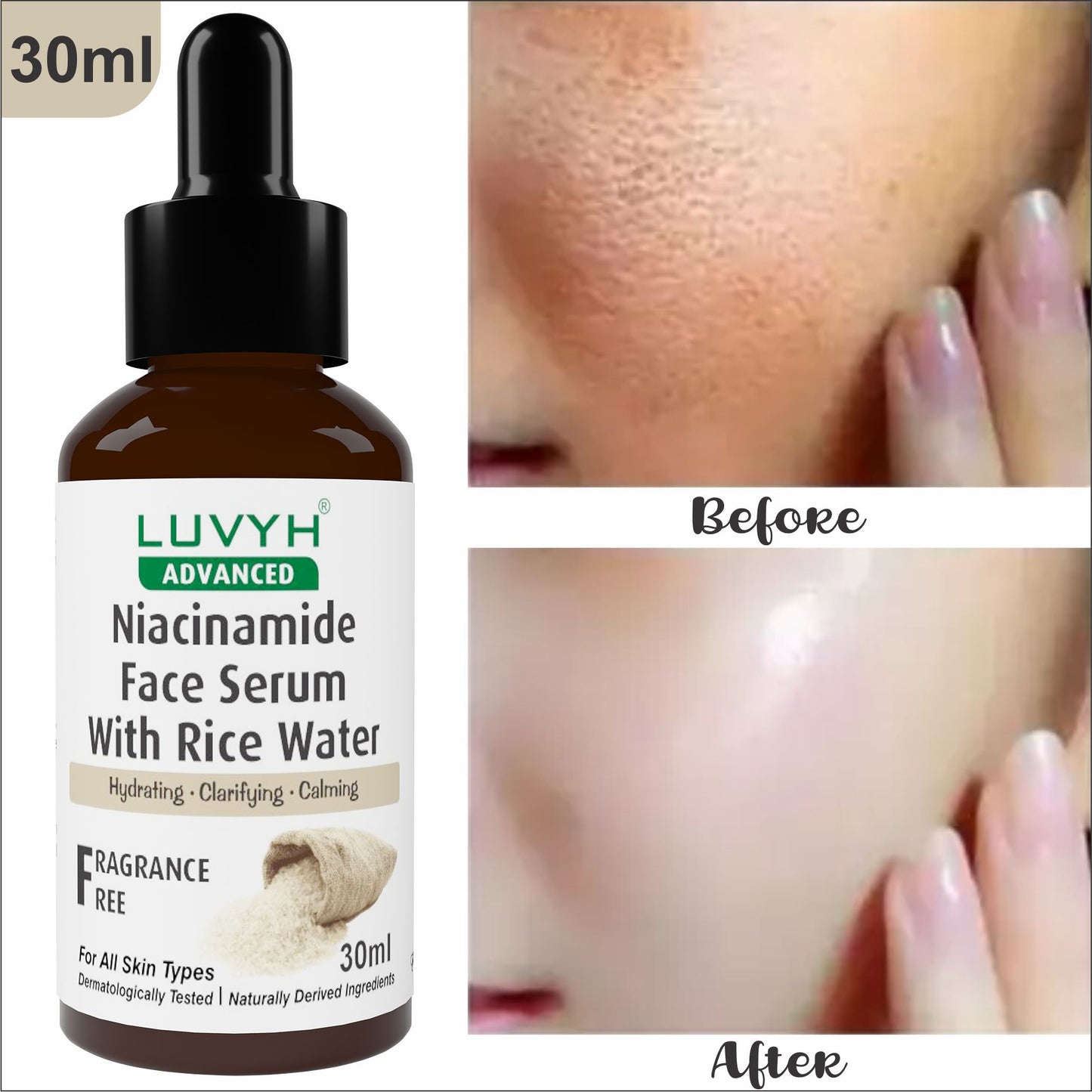 Luvyh Niacinamide Face Serum with Rice Water, Vitamin B3 with Japanese Fermented Rice Water, For Clear, Blemish-Free, Bright Skin, Suits All Skin Types, Fragrance-Free 30ML