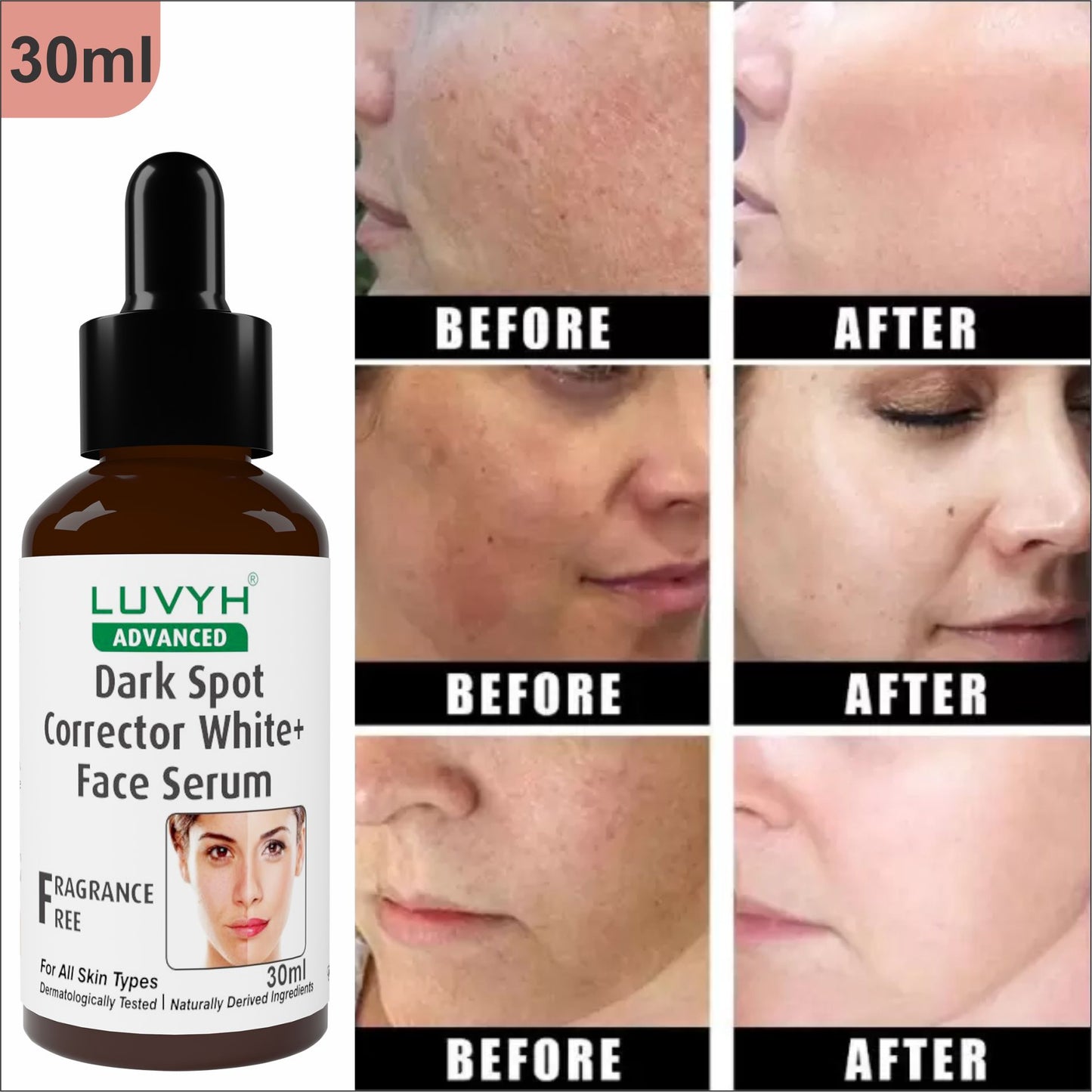 Luvyh Skin Brightening + Dark Spot Serum - Natural Skin Lightener and Dark Spot Corrector – Skin Brightening & Revitalizer Uneven tone and Texture with Advanced Ingredien 30ML