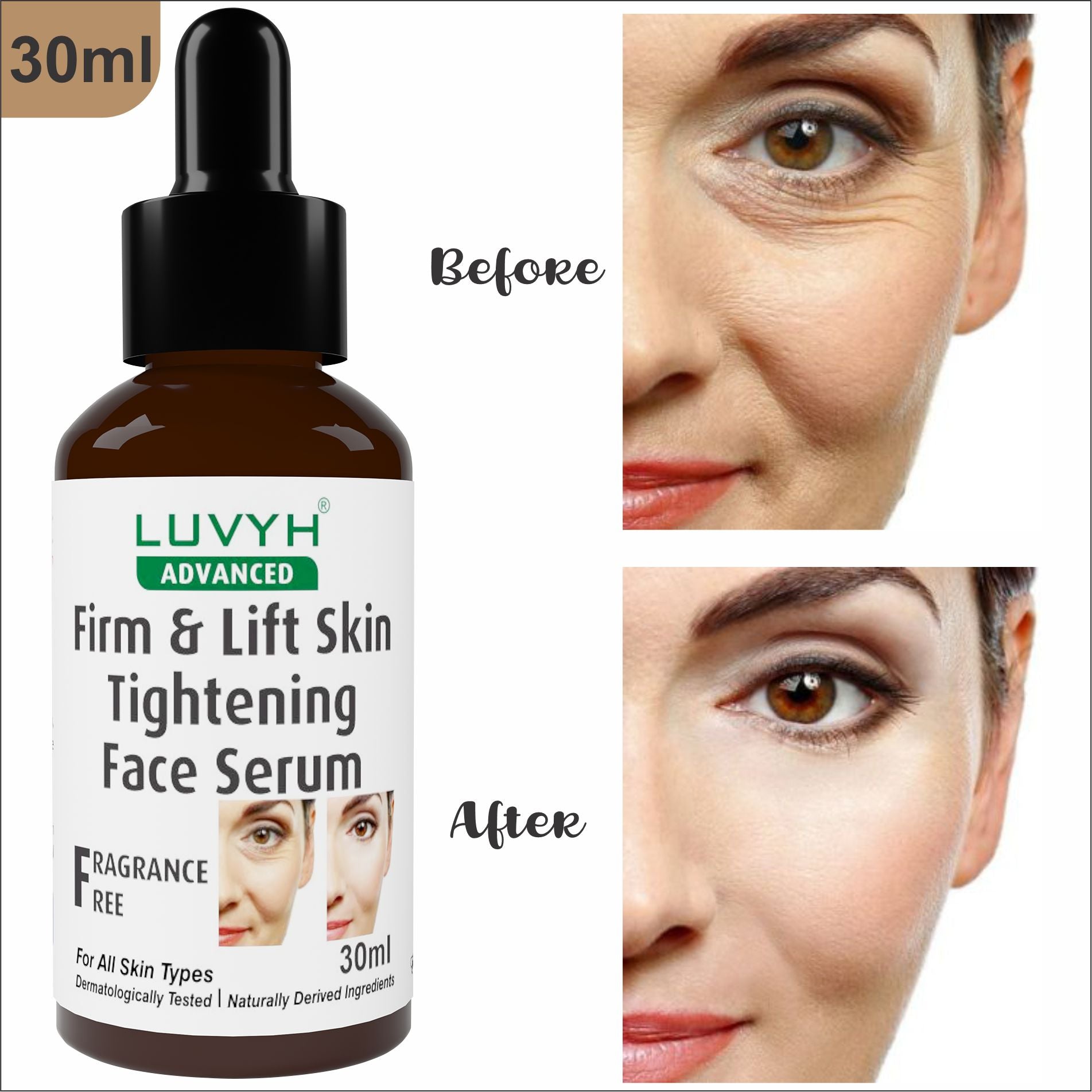 Before and After Results - Firm & Lift Skin Tightening Face Serum