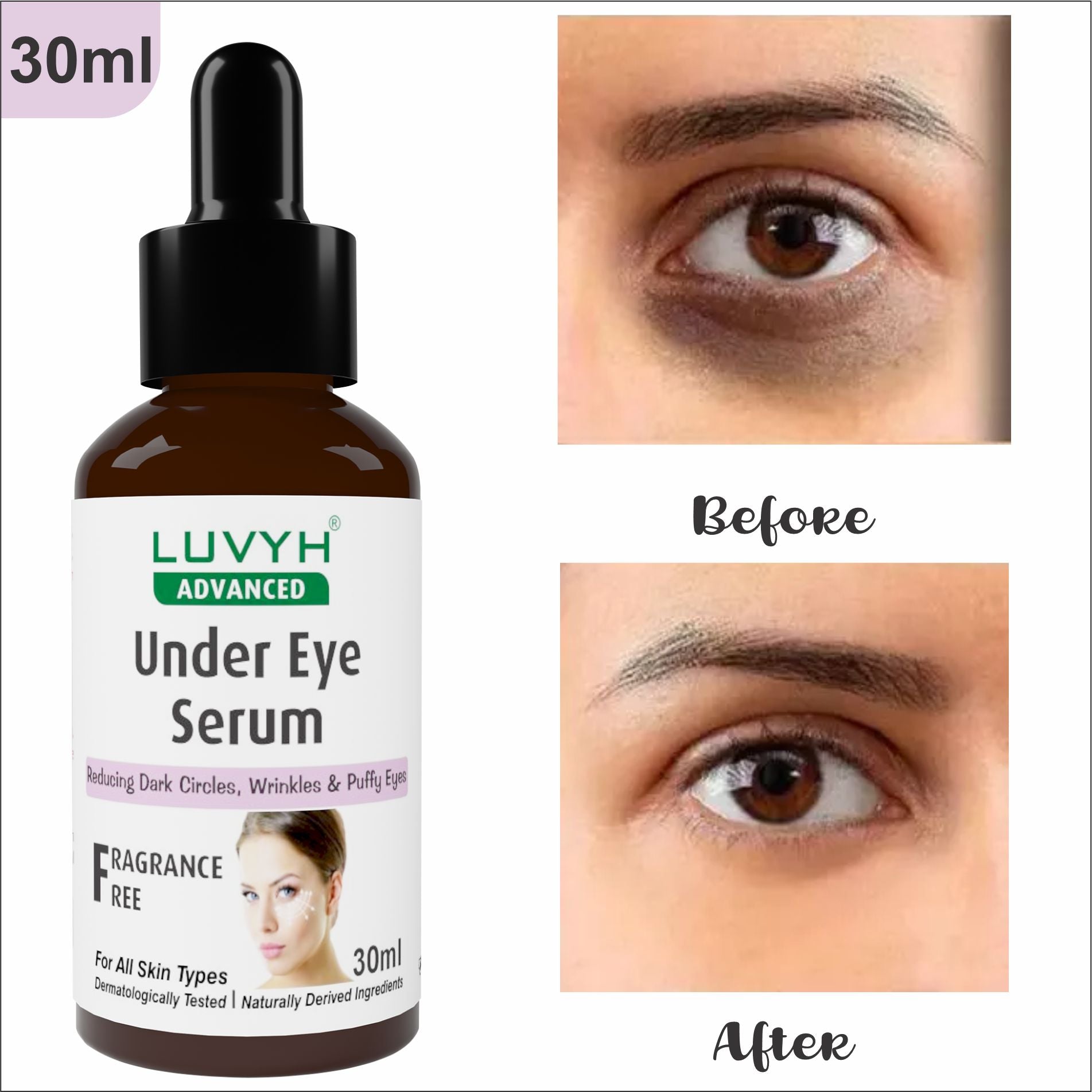 Before and After Results - Under Eye Serum